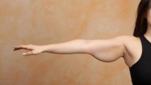 Operasi Penghapusan Kulit Setelah Penurunan Berat Badan